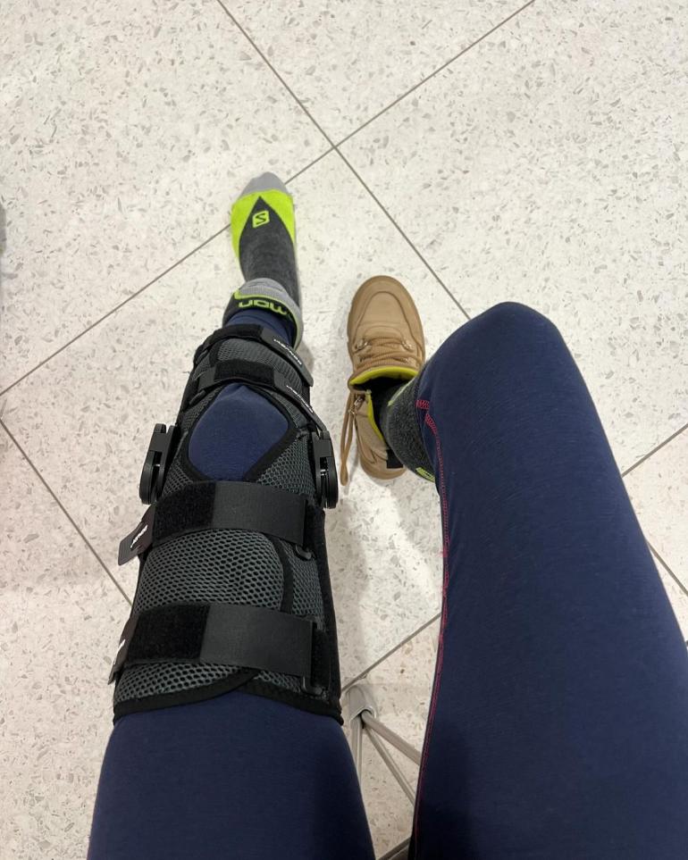 Олена Шоптенко показала травму ноги