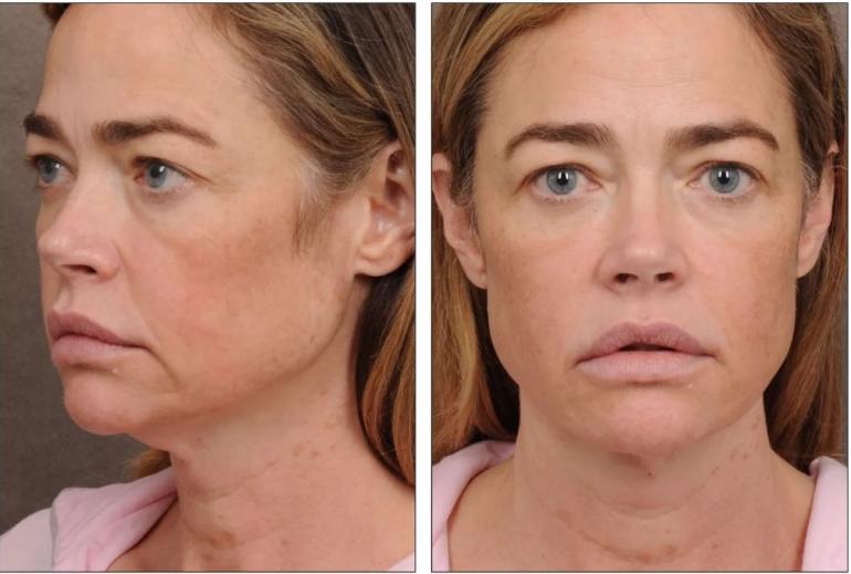 Деніз Річардс